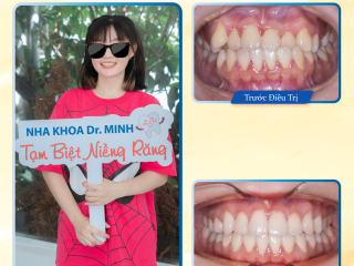 NIỀNG RĂNG DAK LAK