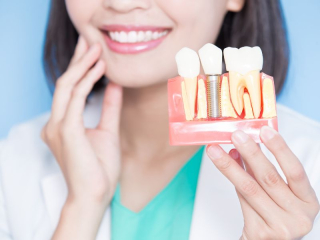 DỊCH VỤ IMPLANT CHẤT LƯỢNG CAO