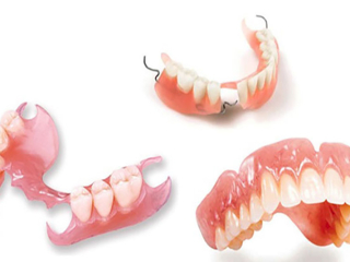 TRỒNG RĂNG HÀM GIẢ THÁO LẮP