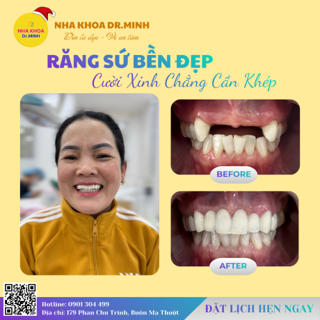 DỊCH VỤ RĂNG SỨ NHA KHOA BMT